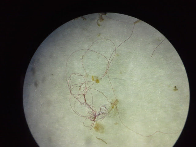 Fibers found in the esophagus of a cormorant